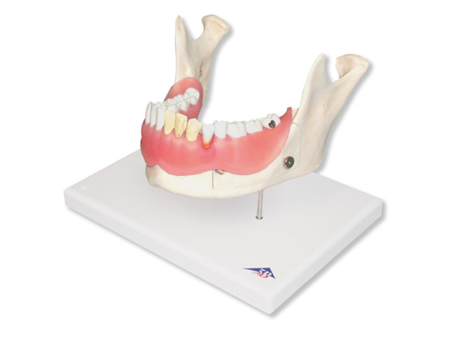 D26 - Zubní onemocnění, 2 krát zvětšené, 21 částí