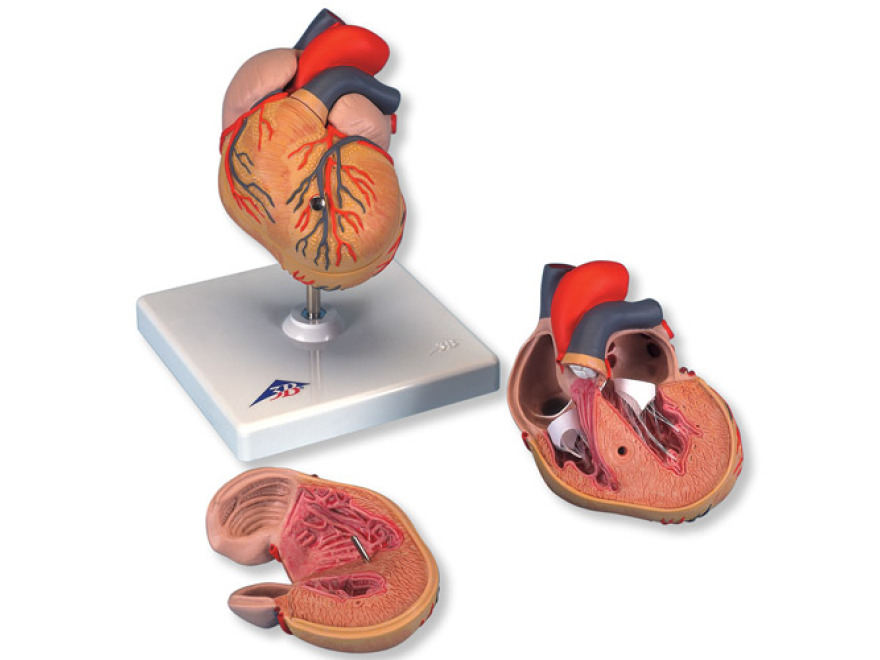 G04 - Klasický model srdce s hypertrofií levé komory, 2 části