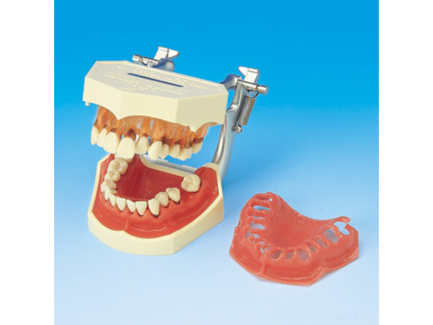 Model onemocnění parodontu PE-PER001