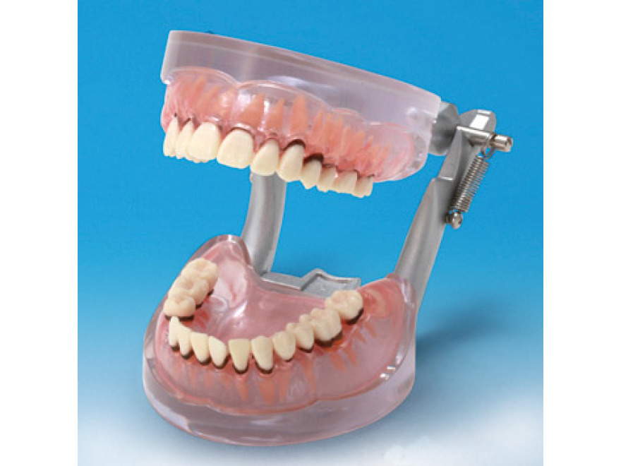 Model onemocnění parodontu PE-PER004