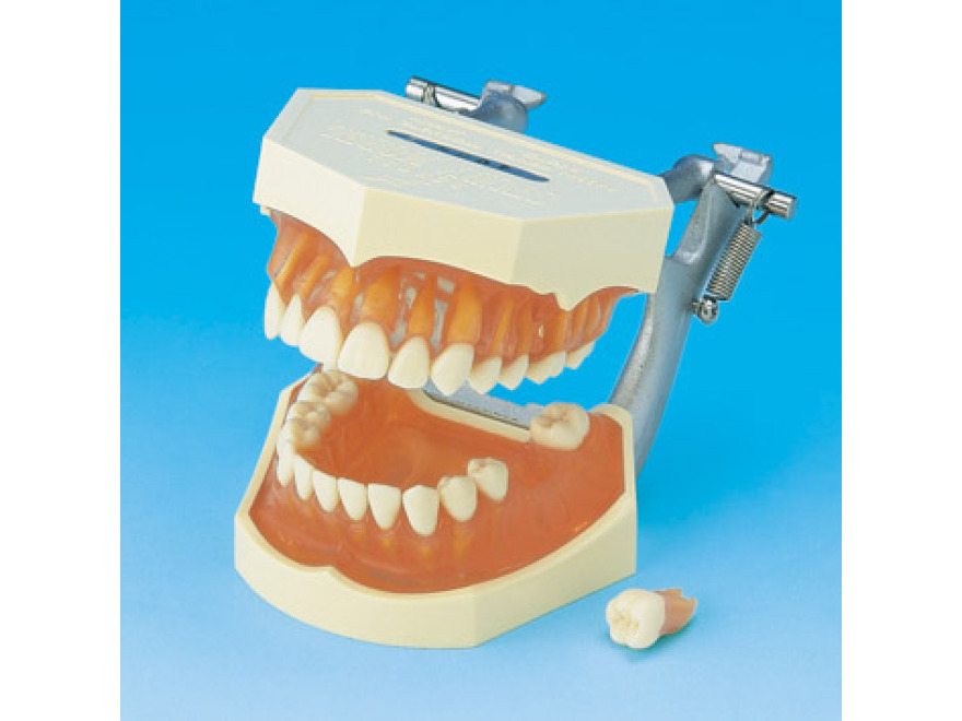 Model s odnmatelnmi zuby (dse z transparentnho rovho silikonu)