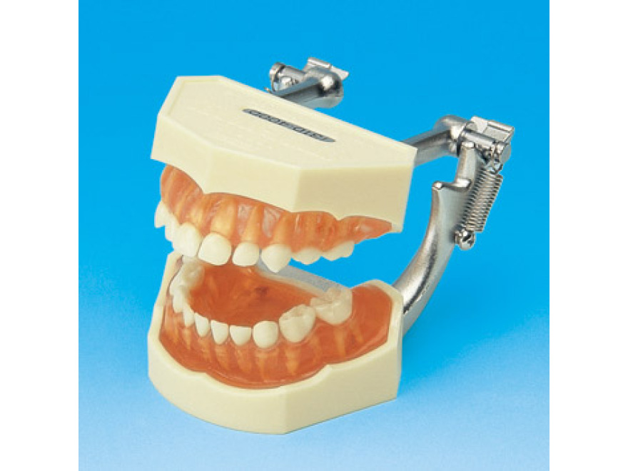 Model s odnmatelnmi zuby  mln chrup (dse z transparentnho rovho silikonu)