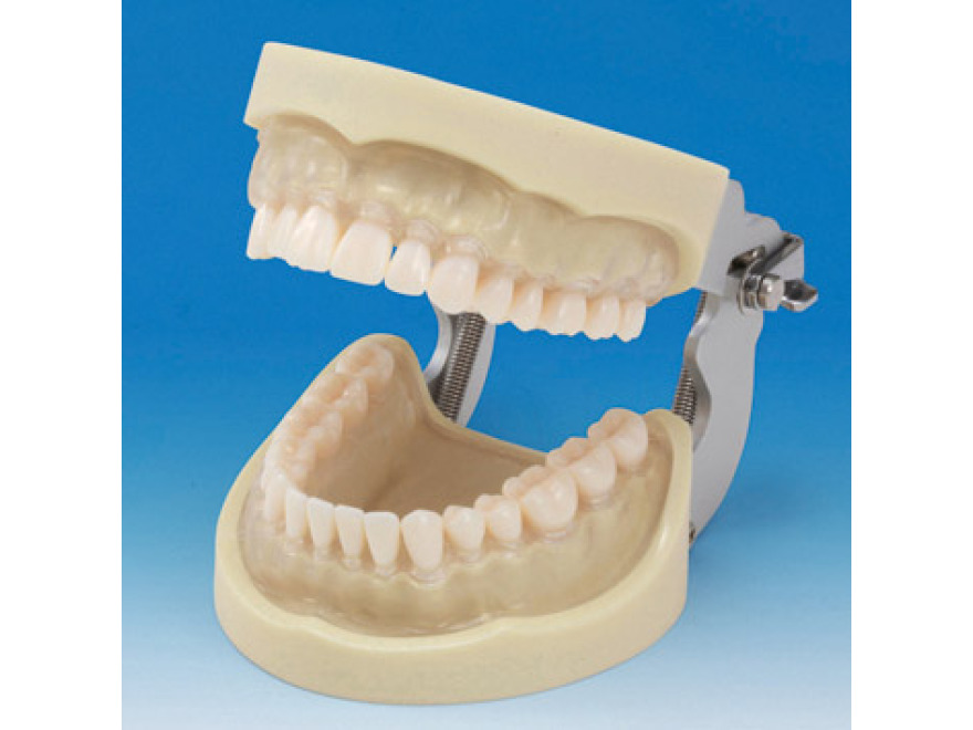 Model elisti s protetickou nhradou (32 zub) - transparentn dse