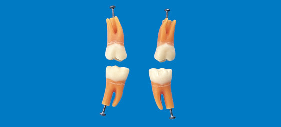 Model zubu s rozvtvenm koenem (zub . 16)