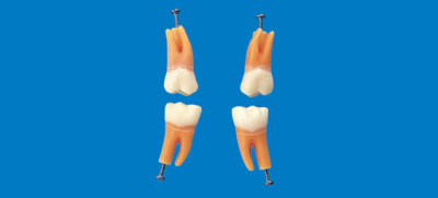 Root Furcation Tooth Model A2A-700 (#46)