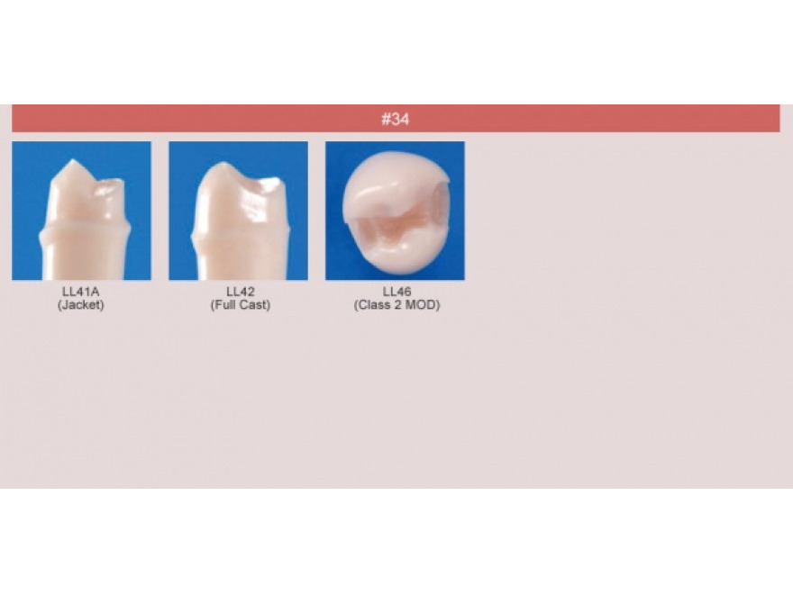 Model zubu pro přípravu pilíře můstku a čištění zubu před výplní (zub č. 34)