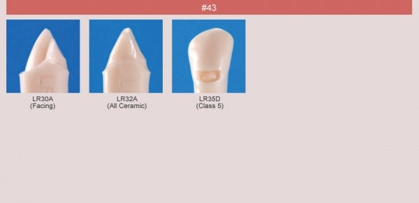 Model zubu pro ppravu pile mstku a itn zubu ped vpln (zub . 43)
