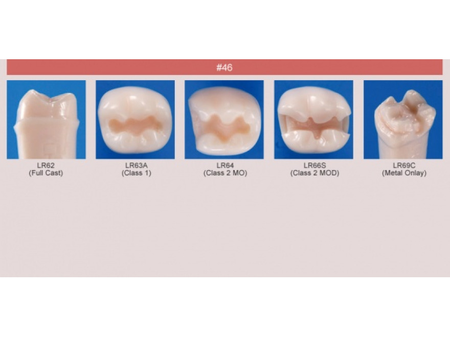 Model zubu pro přípravu pilíře můstku a čištění zubu před výplní (zub č. 46)