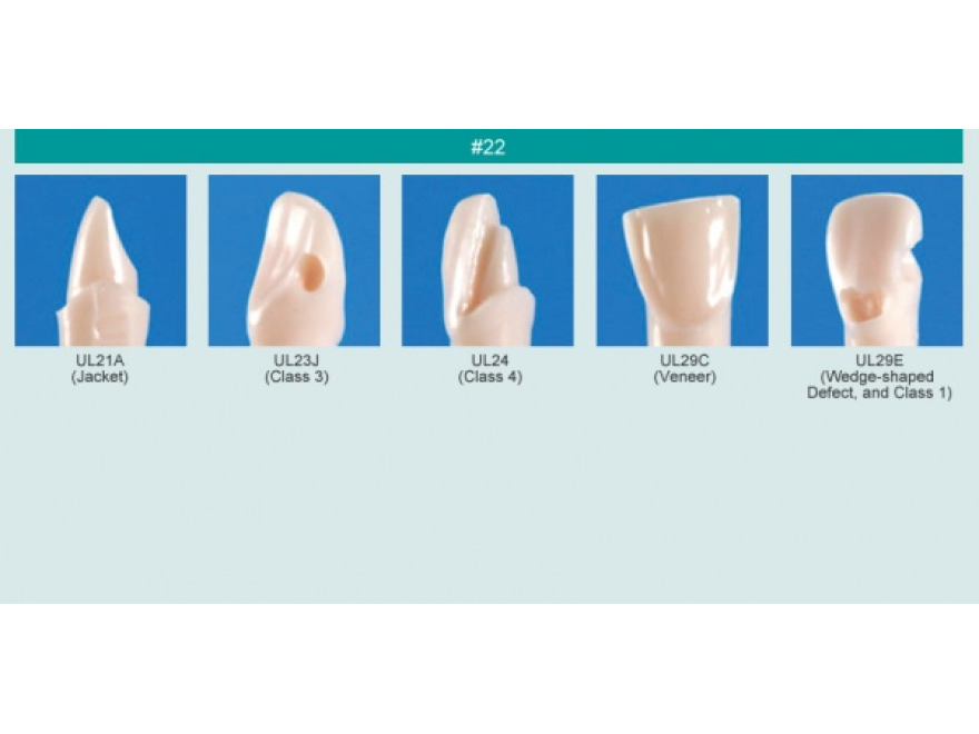 Model zubu pro přípravu pilíře můstku a čištění zubu před výplní (zub č. 22)