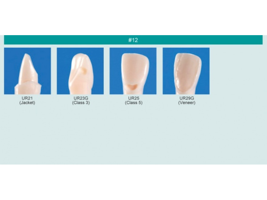 Model zubu pro přípravu pilíře můstku a čištění zubu před výplní (zub č. 12)