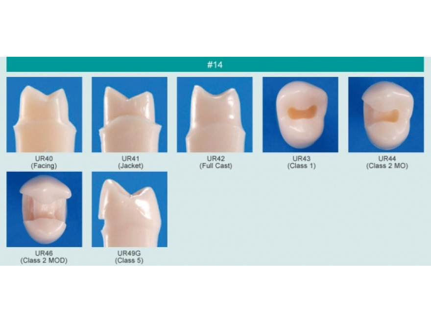 Model zubu pro přípravu pilíře můstku a čištění zubu před výplní (zub č. 14)