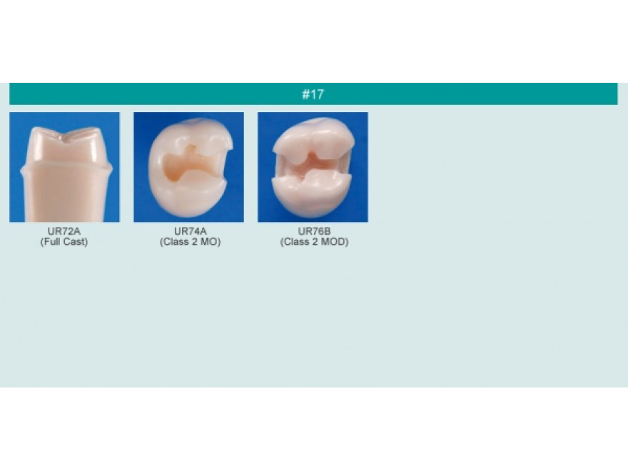 Model zubu pro přípravu pilíře můstku a čištění zubu před výplní (zub č. 17)