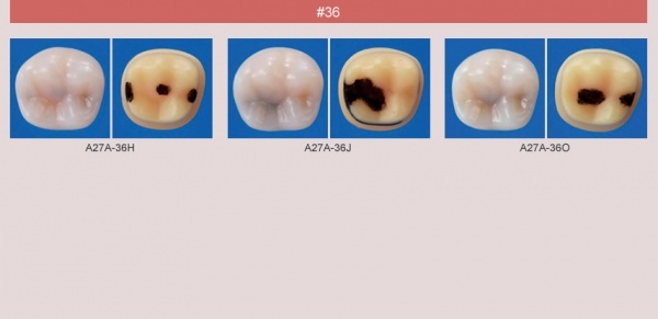 Model zubu se zubnm kazem (zub . 36)