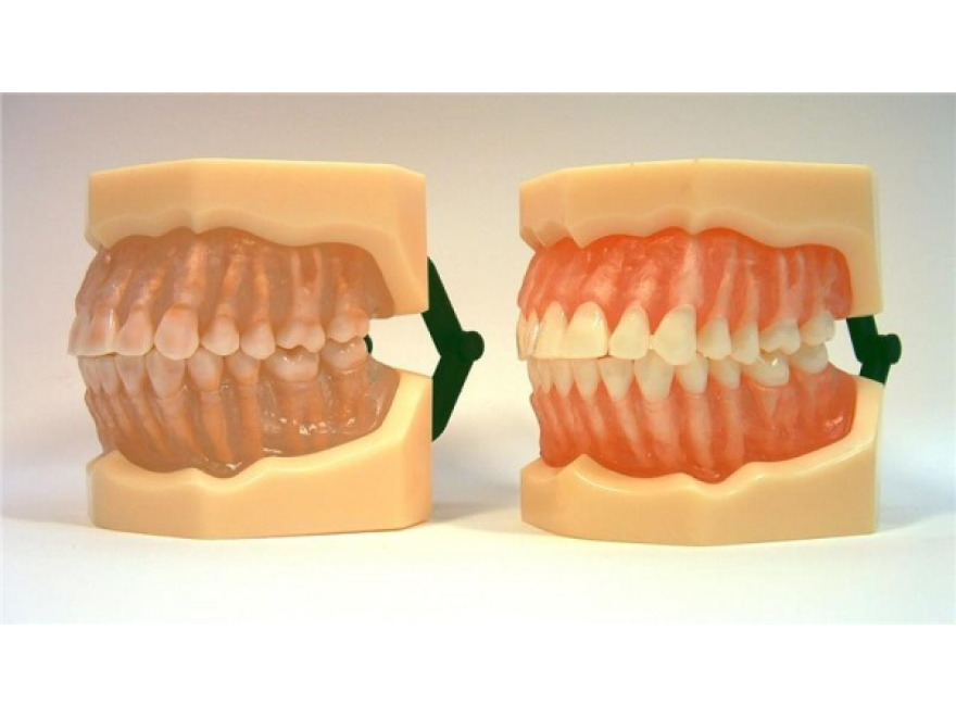 MDO-07 - Vyjmateln anatomick zuby