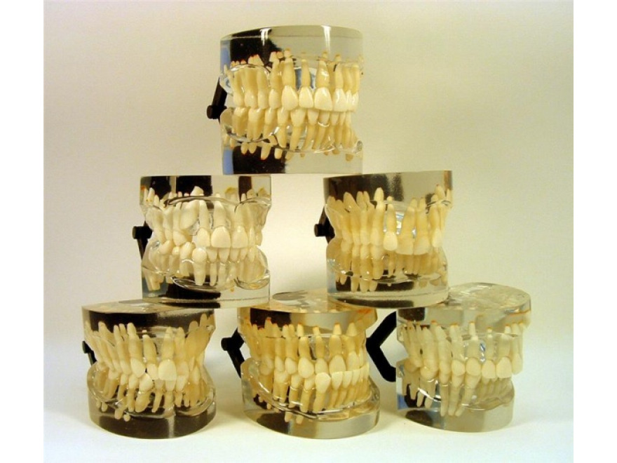 MDO-18 - Ortodontické modely