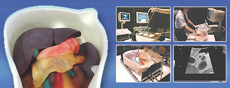 US-3 - Model k ncviku intraoperan a laparoskopick sonografie IOUSFAN