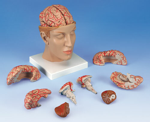 C25 - Mozek s tepnami v hlav