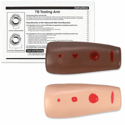 SB25973 - Pae pro tuberkulinov test