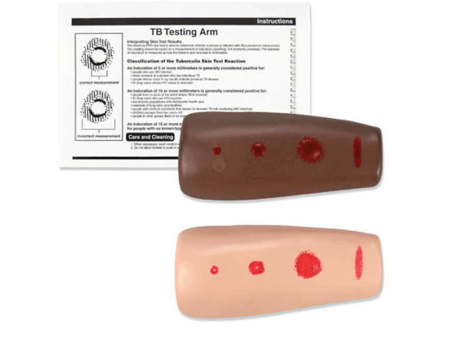 SB25973 - Pae pro tuberkulinov test